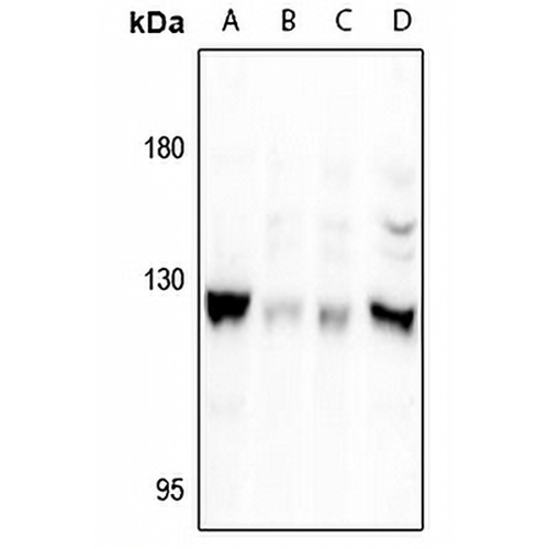 Focal Adhesion Kinase (Phospho-S722) Rabbit Polyclonal Antibody