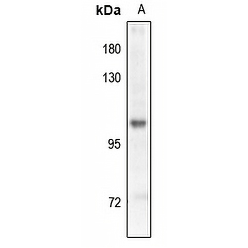 GABBR2 (Phospho-S893) Rabbit Polyclonal Antibody