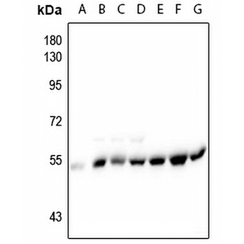 Alpha-tubulin (Phospho-Y272) Rabbit Polyclonal Antibody