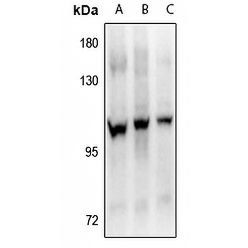 FGFR4 (Phospho-Y642) Rabbit Polyclonal Antibody