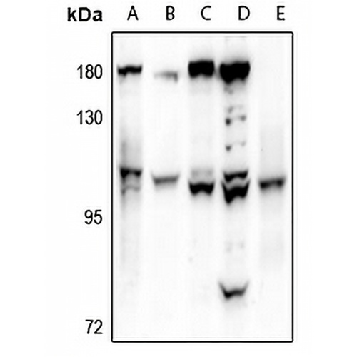 VAV1 Rabbit Polyclonal Antibody