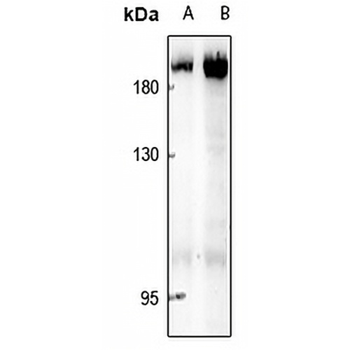 ABL1/2 Rabbit Polyclonal Antibody