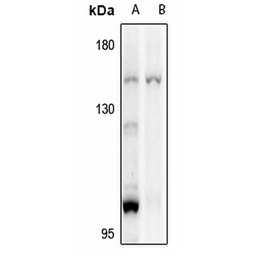 PLC gamma 2 Rabbit Polyclonal Antibody