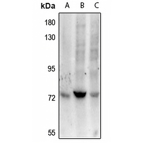 ZAP70 Rabbit Polyclonal Antibody
