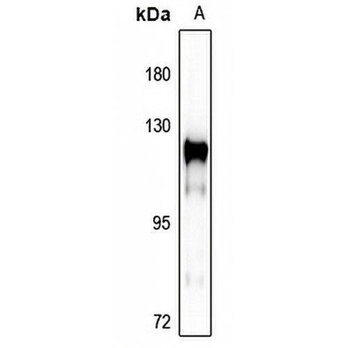 p130 Cas Rabbit Polyclonal Antibody