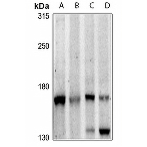PLC beta 3 Rabbit Polyclonal Antibody