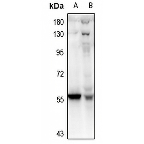 PFKFB2 Rabbit Polyclonal Antibody