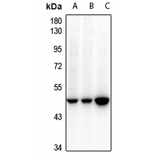Cytokeratin 18 Rabbit Polyclonal Antibody