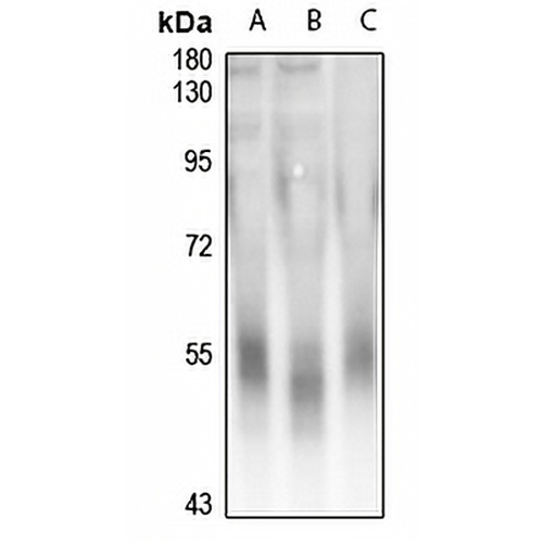 DAP Kinase 3 Rabbit Polyclonal Antibody