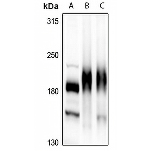 HER3 Rabbit Polyclonal Antibody