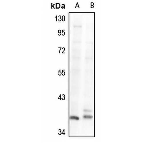 GNAZ Rabbit Polyclonal Antibody