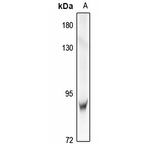 IRAK1 Rabbit Polyclonal Antibody