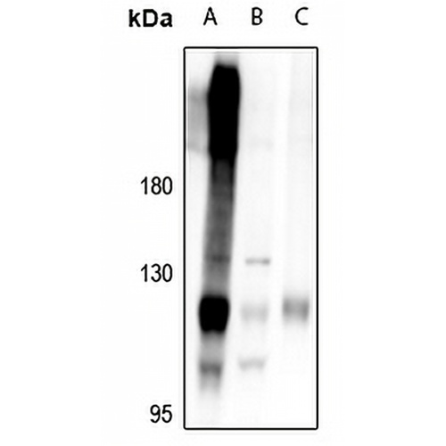 RB1 Rabbit Polyclonal Antibody