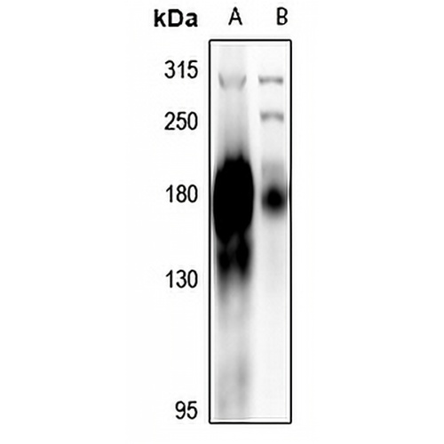 EGFR Rabbit Polyclonal Antibody