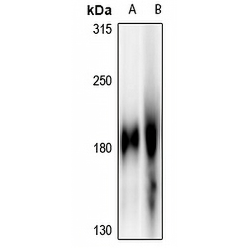 EGFR Rabbit Polyclonal Antibody