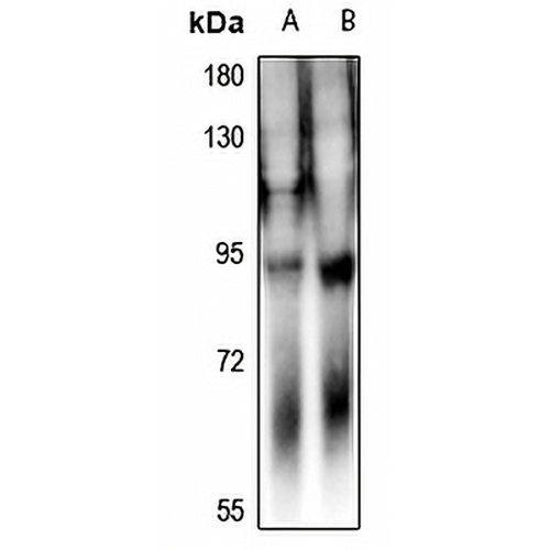 DAB1 Rabbit Polyclonal Antibody