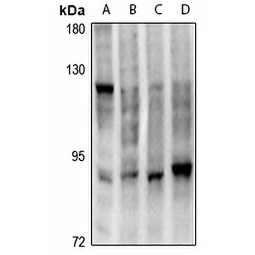 HSF1 Rabbit Polyclonal Antibody