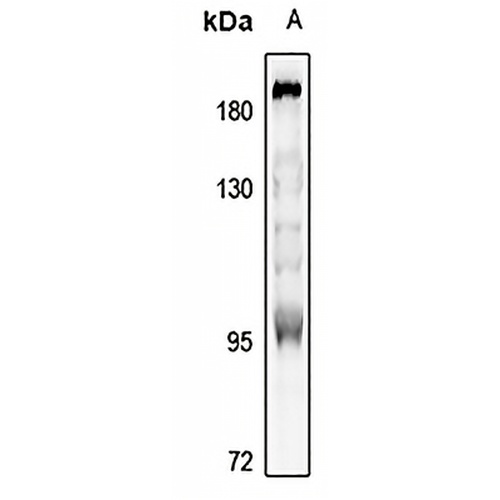 MUSK Rabbit Polyclonal Antibody