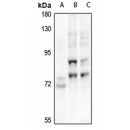 p73 Rabbit Polyclonal Antibody
