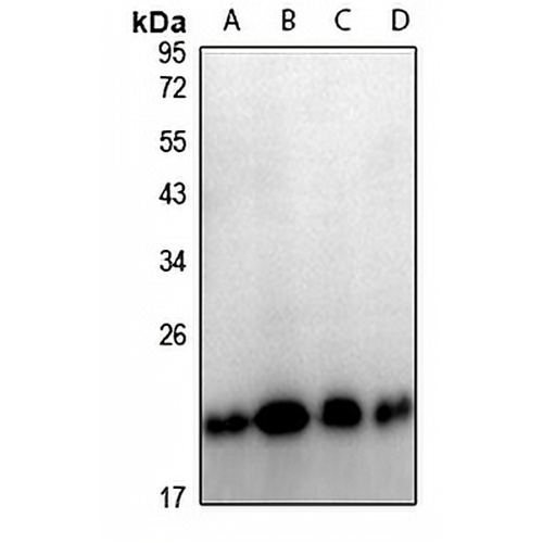 TPD52L2 Rabbit Polyclonal Antibody