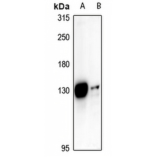 ST18 Rabbit Polyclonal Antibody
