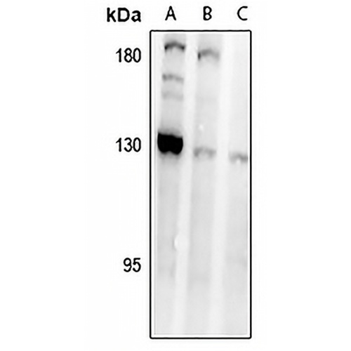 MAGEC1 Rabbit Polyclonal Antibody