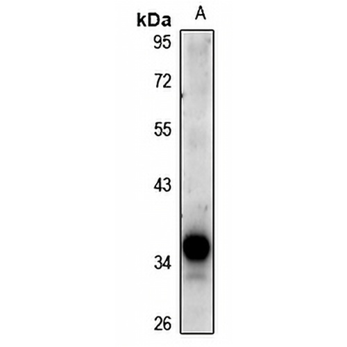DCR3 Rabbit Polyclonal Antibody