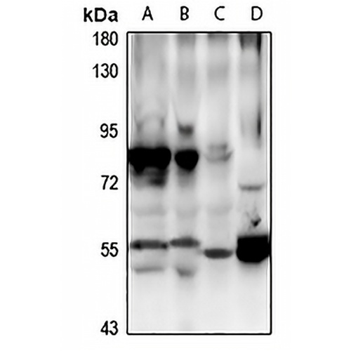 CBX6 Rabbit Polyclonal Antibody