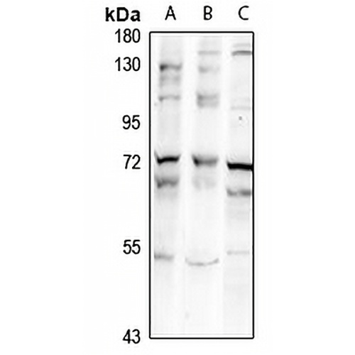 ZNF18 Rabbit Polyclonal Antibody