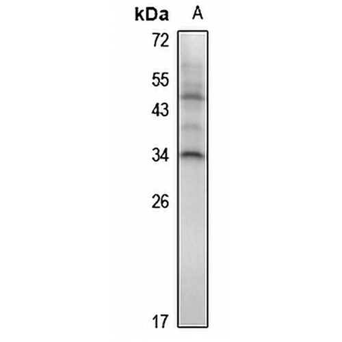 HOXA7 Rabbit Polyclonal Antibody