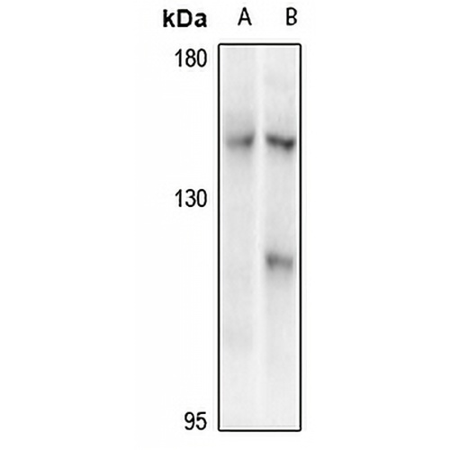CIITA Rabbit Polyclonal Antibody