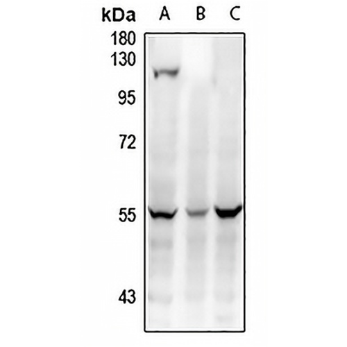 WTAP Rabbit Polyclonal Antibody