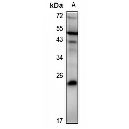DUSP19 Rabbit Polyclonal Antibody