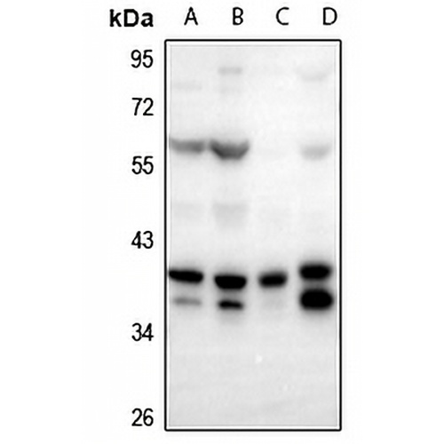 FOXB1/2 Rabbit Polyclonal Antibody