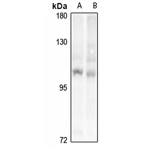 PRKD1/2/3 Rabbit Polyclonal Antibody