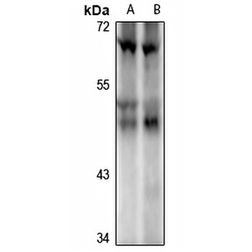 ILKAP Rabbit Polyclonal Antibody