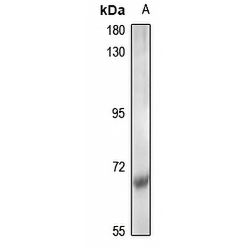 CDK5RAP1 Rabbit Polyclonal Antibody