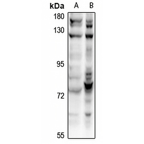 CDC16 Rabbit Polyclonal Antibody
