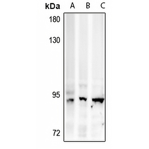 AMPD3 Rabbit Polyclonal Antibody