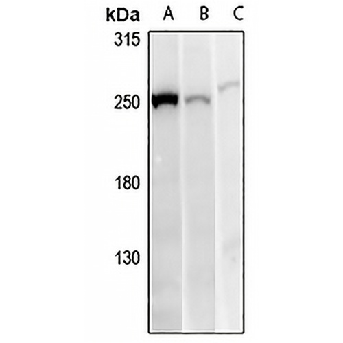 ANKRD26 Rabbit Polyclonal Antibody