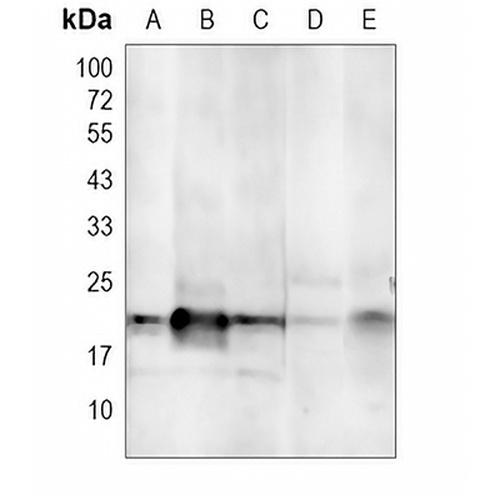Aquaporin 5 Rabbit Polyclonal Antibody