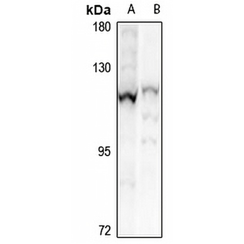 CHSY3 Rabbit Polyclonal Antibody