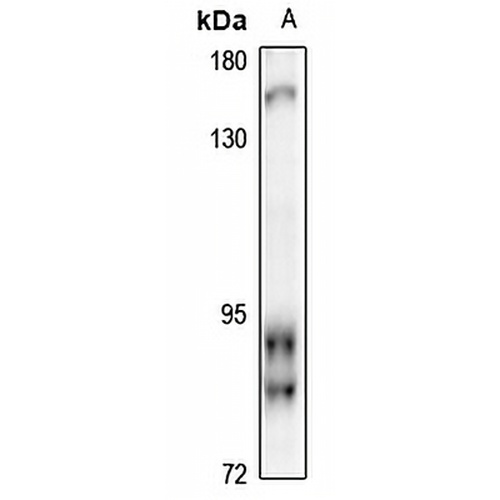 RFX2 Rabbit Polyclonal Antibody