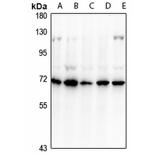 CD39 Rabbit Polyclonal Antibody