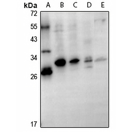 GSTT1 Rabbit Polyclonal Antibody