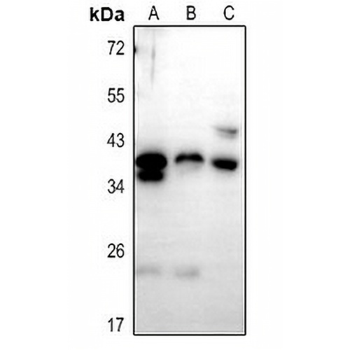 PTGR1 Rabbit Polyclonal Antibody