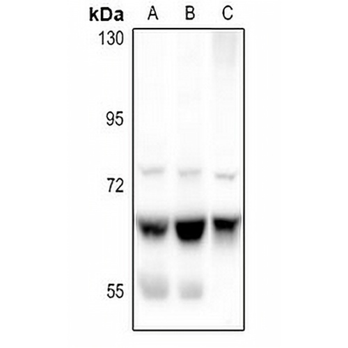 ME1 Rabbit Polyclonal Antibody
