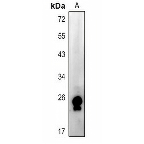 RAB15 Rabbit Polyclonal Antibody