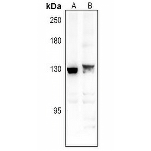 Spinophilin Rabbit Polyclonal Antibody