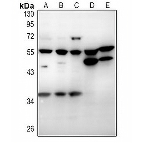 CD215 Rabbit Polyclonal Antibody